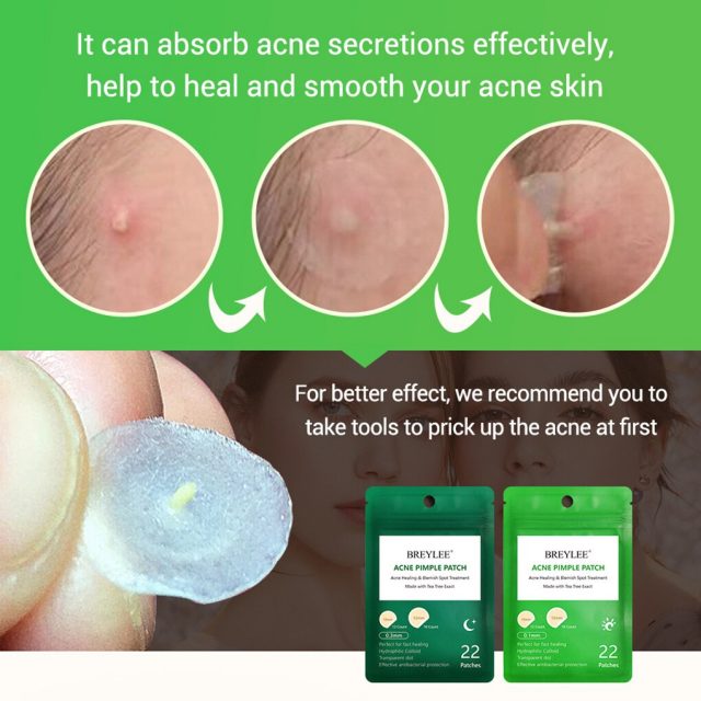 hengfangBREYLEE Acne Remover Patch Anti Acne Blackhead Pimple Blemish Treatment Sticker Skin Care Mask Facial Tools